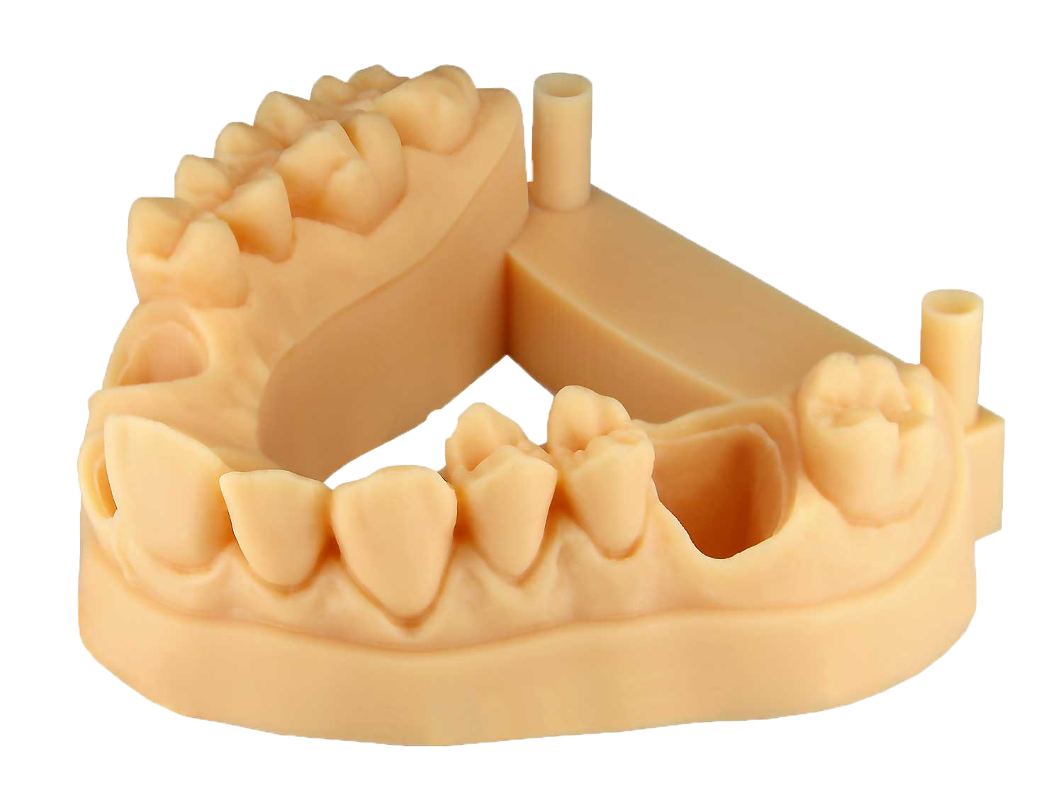 E-Denstone-main Impression 3D : l'avenir du dentaire