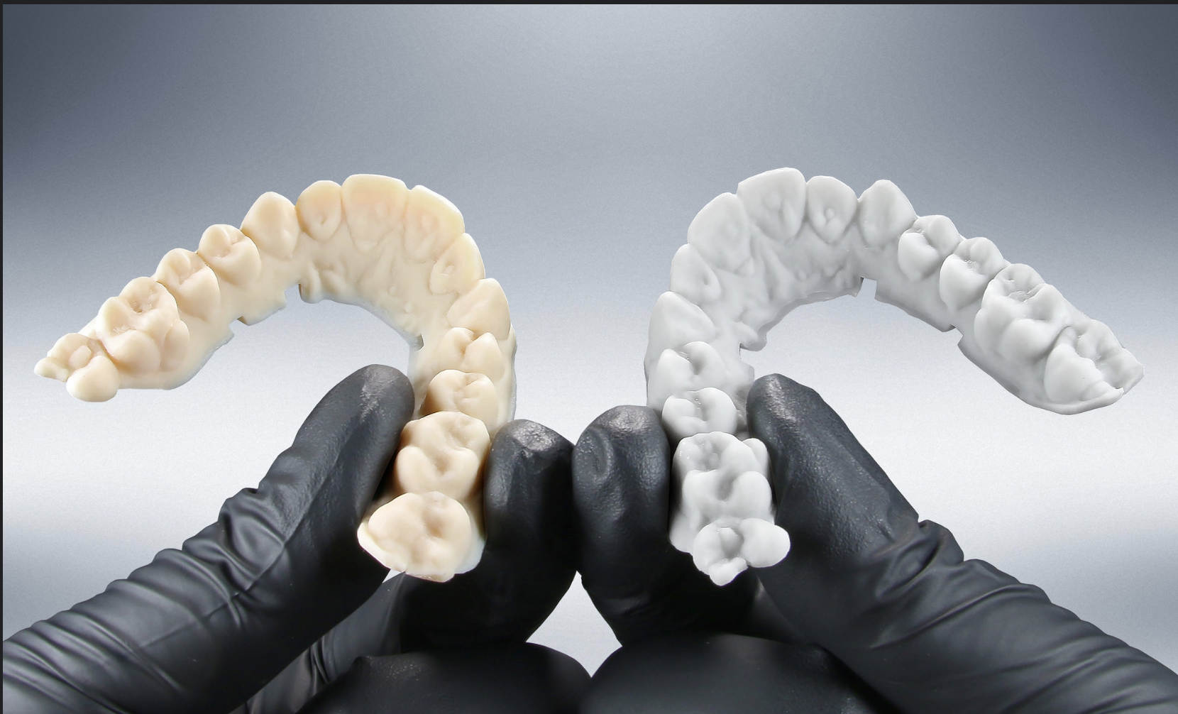 dentaire Impression 3D : l'avenir du dentaire